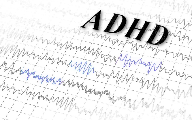 IL qEEG NELLA VALUTAZIONE DELLADHD